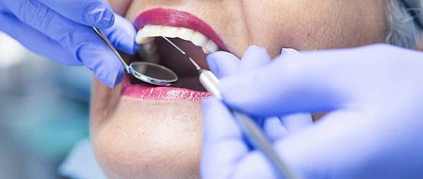 Best Emergency Treatment for Oral Infections in El Rancho, NM
